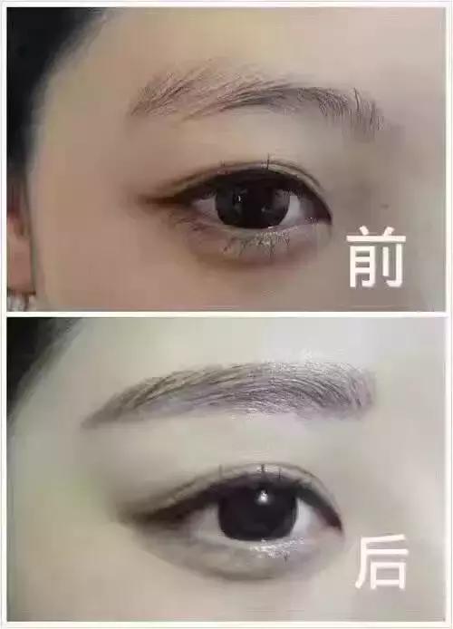 纹眉后有啥注意事项,纹眉后注意事项要用修复精华吗