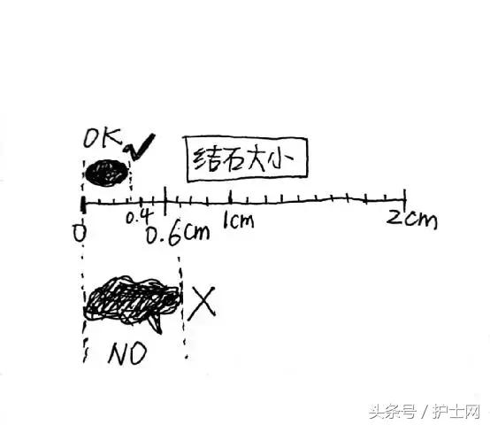 经常跳跳就可以将肾结石蹦出来吗,经常跳跳有助于长高吗