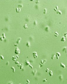 谷氨酸棒杆菌基因组提取方法 (棒杆菌中的谷氨酸合成途径)