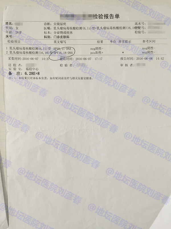 hpv感染引起湿疣或宫颈上皮内病变,高危传染型hpv51