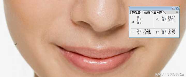 拔牙可以瘦脸轮廓吗,拔牙真的可以瘦脸吗