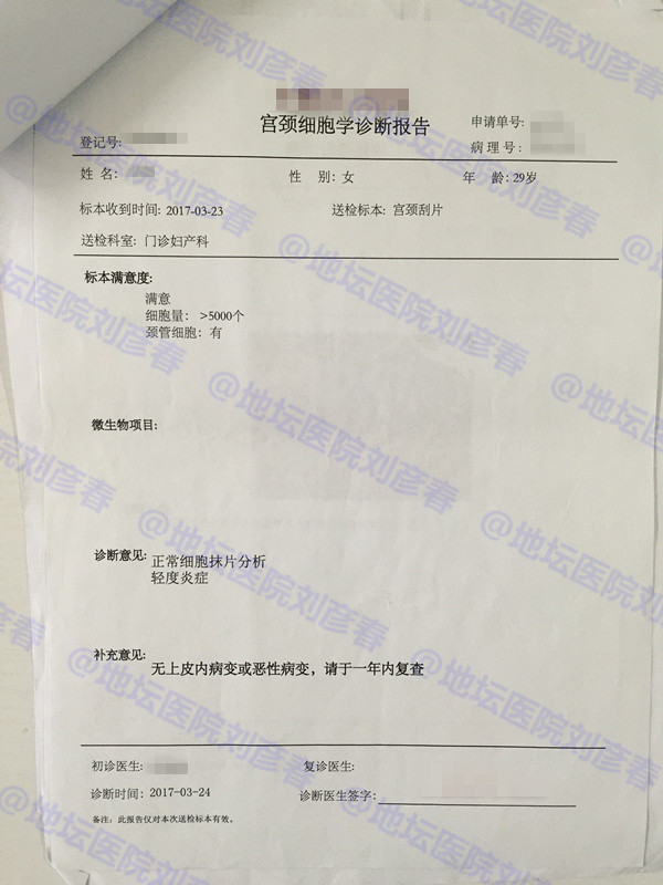 hpv感染引起湿疣或宫颈上皮内病变,高危传染型hpv51