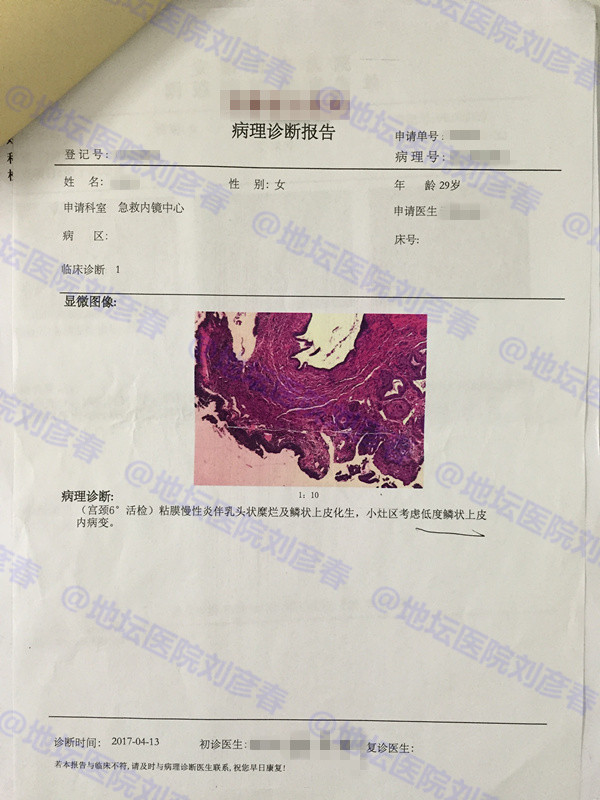 hpv感染引起湿疣或宫颈上皮内病变,高危传染型hpv51