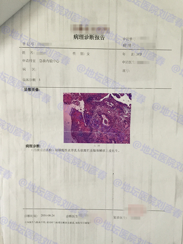 hpv感染引起湿疣或宫颈上皮内病变,高危传染型hpv51