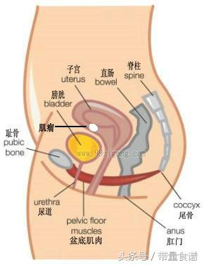 子宫肌瘤一般良性还是恶性肿瘤,子宫肌瘤是良性肿瘤