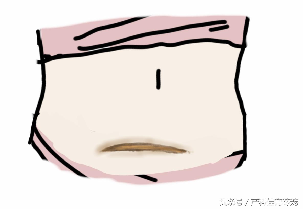 鐦㈢棔鐤欑槱鏄尰瀛﹂毦棰樺悧,涓栫晫闅鹃鐦㈢棔鐤欑槱