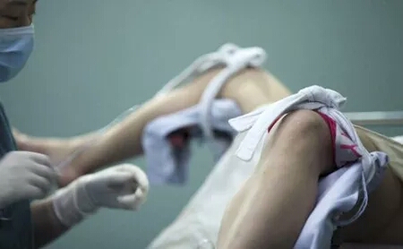 不孕不育的5大原因和表现,不孕不育的卵子是怎样的