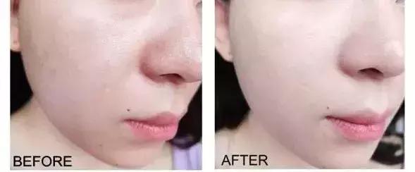 10块钱以内的护肤品好物,10元以内国货好用平价护肤品