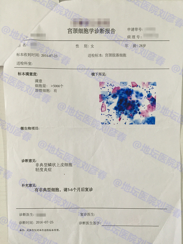 hpv感染引起湿疣或宫颈上皮内病变,高危传染型hpv51