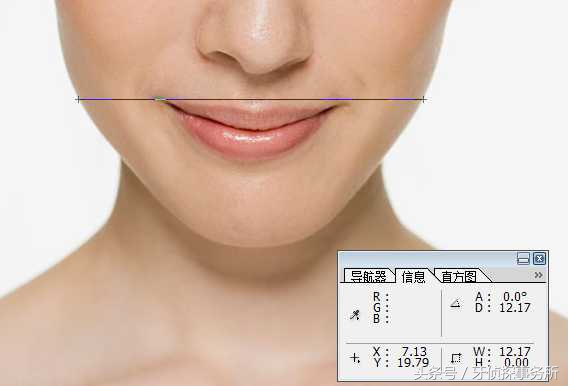 拔牙可以瘦脸轮廓吗,拔牙真的可以瘦脸吗