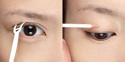 双眼皮贴总是贴的不满意,双眼皮总贴不好