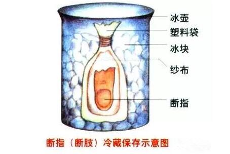 平安好医生解决难题,平安好医生医疗问诊