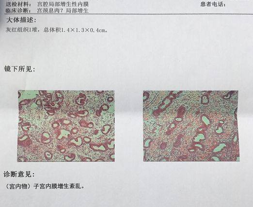 试管移植反复失败不着床怎么回事,试管婴儿着床后多次生化血值太低