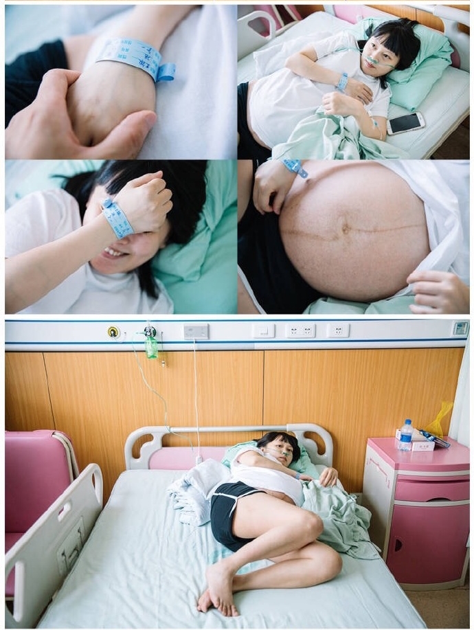 孕期甲减？胎盘低？胎位不正？你的孕期比我更糟心吗？