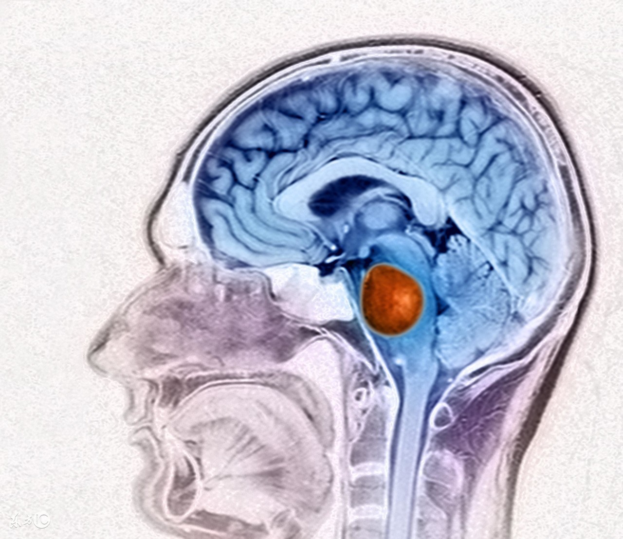 脑瘤患者术后吃什么食物好,脑瘤手术后吃什么食物最好