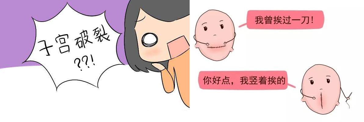 剖腹产后想要二胎,剖腹产后还想要三胎去医院查什么