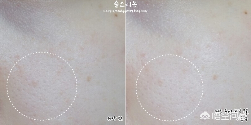 清洁黑头收缩毛孔的最好办法,清洁黑头收缩毛孔是真的吗