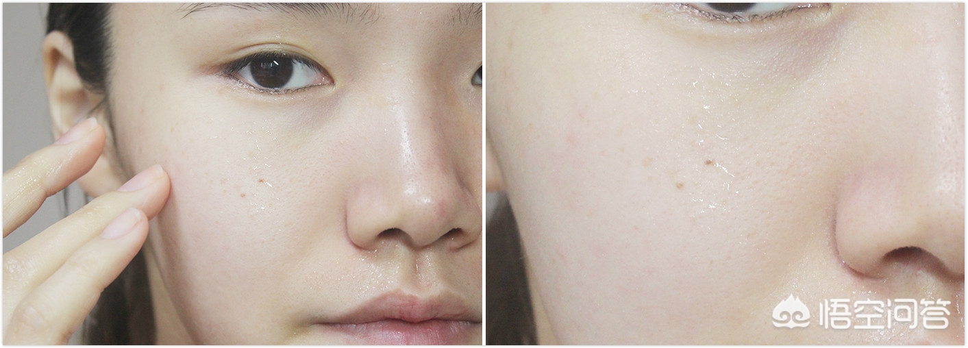 清洁黑头收缩毛孔的最好办法,清洁黑头收缩毛孔是真的吗