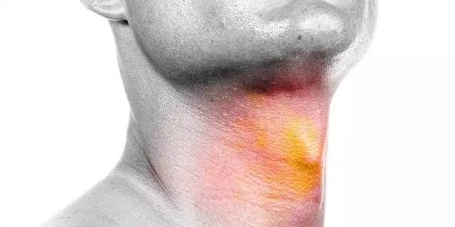 主持人平时怎么养嗓子,主持人护嗓子小妙招