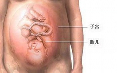 剖宫产分娩选择,剖腹产和顺产到底该如何选择