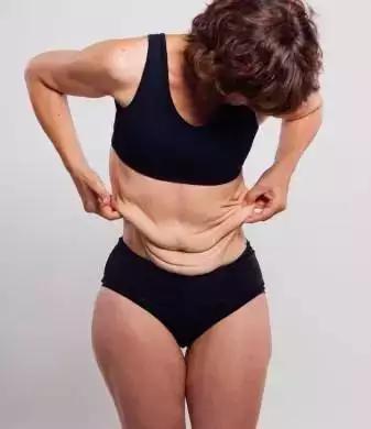 减肥后肚子皮肤松弛大概多久恢复,减肥后脸部皮肤松弛能自己恢复吗