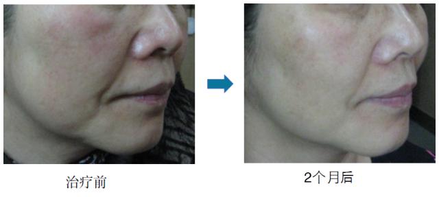 健康科普术后的护理方法,术后养护真的很重要