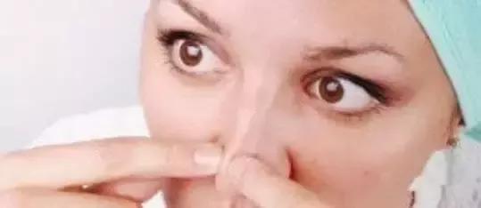 黑头都去不干净，难怪你没人追