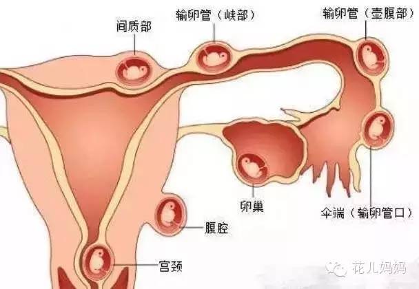 怀孕后竟然来了大姨妈?医生说:那不是好姨妈!