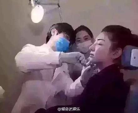 打玻尿酸的明星,为什么明星都要打玻尿酸