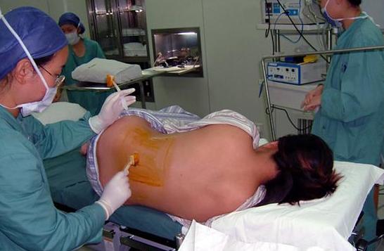 经历了剖腹产才知道妈妈的不容易,看完剖宫产过程你就会明白