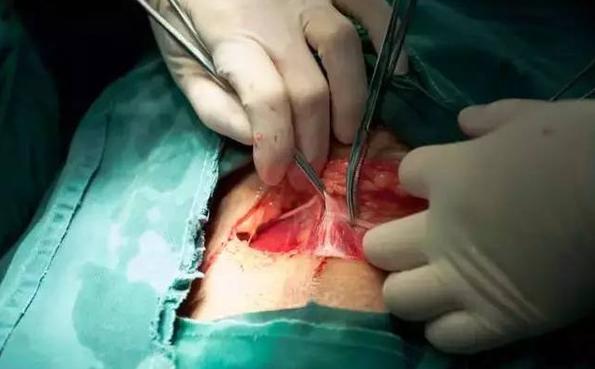 经历了剖腹产才知道妈妈的不容易,看完剖宫产过程你就会明白