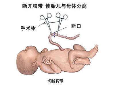 剖宫产分娩选择,剖腹产和顺产到底该如何选择