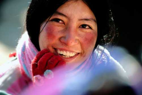 面部红血丝用什么可以彻底消除,怎样才能有效去除面部红血丝