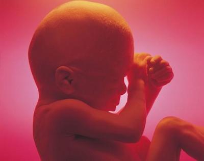 孕期尿床别忽视,产前尿失禁怎么回事