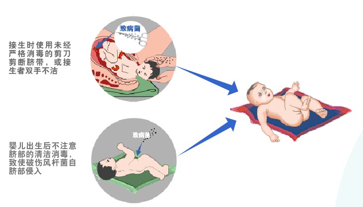 怎么预防破伤风最有效,受伤后怎样预防破伤风
