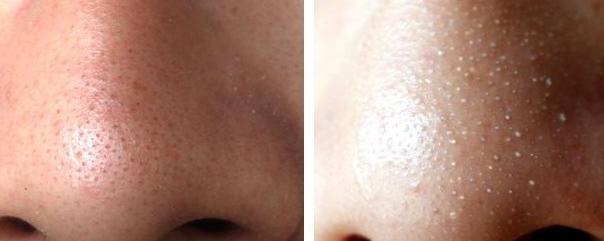 补水控油最有效 (补水控油的最佳方法)