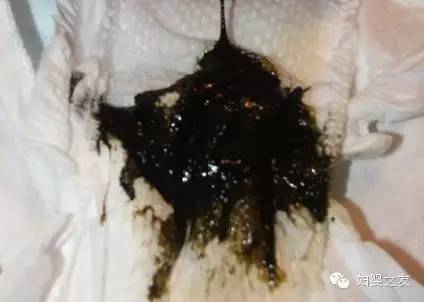 新生儿怎么知道喂多少奶合适,妈妈喂母乳怎么知道量