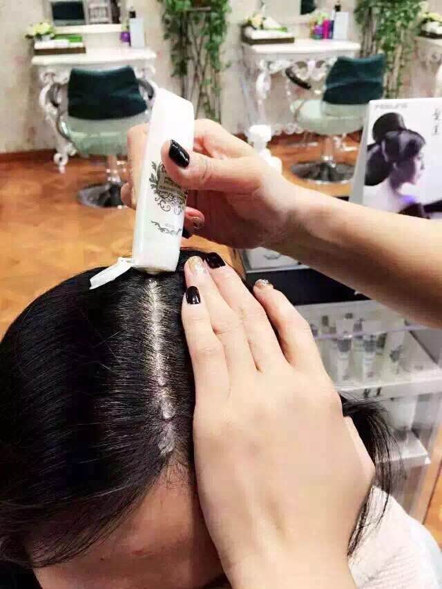 春季头发痒头屑多,春季头屑太多