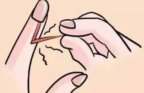 「涨姿势」随手一撕倒刺，她手指肿成萝卜！看完还敢手欠吗？