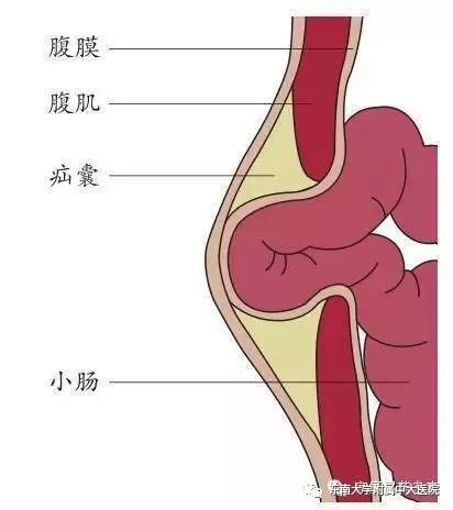 「聚焦」第二届中大论坛收官之作,中外微创外科名家金陵“论剑”