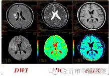 「高精设备」顶级MR7503.0T磁共振，疯狂打Call~