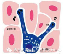 色素斑最佳解决方法,色素斑怎么防治