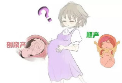 母婴电台·VOL27：顺产VS剖宫产，医生为你剖析利与弊！