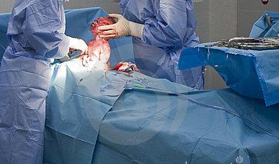 经历了剖腹产才知道妈妈的不容易,看完剖宫产过程你就会明白