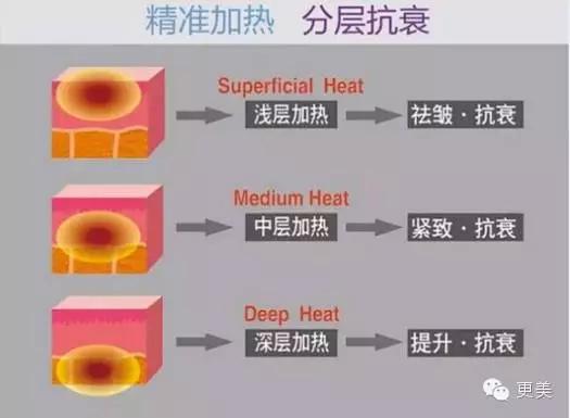 比超声刀更好的治疗方法,膨体隆鼻一年后鼻尖有个痘