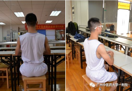 脊柱侧弯属于严重残疾吗,儿童脊柱侧弯去哪个医院好