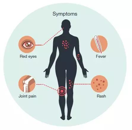 寨卡病毒引发致命并发症,寨卡病毒会导致胎儿出现什么情况