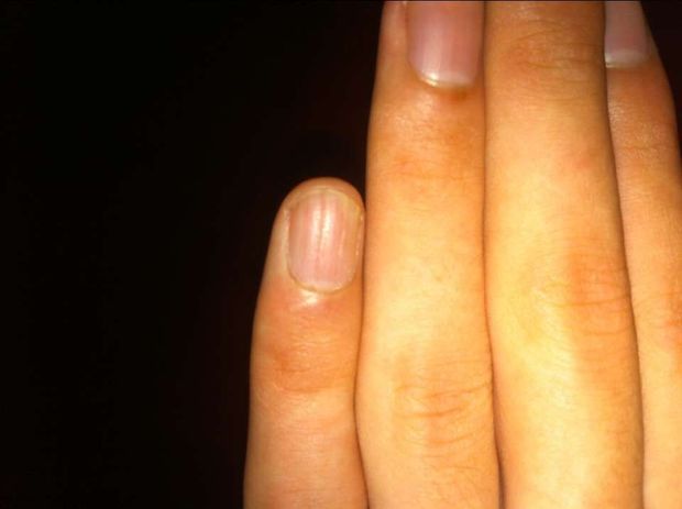 身体缺东西去医院查什么,身体缺啥应该查啥