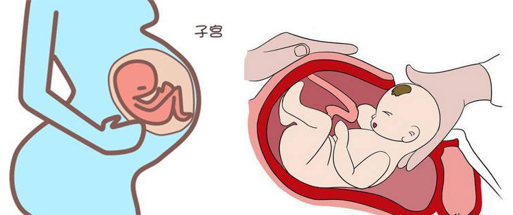 剖腹产后想要二胎,剖腹产后还想要三胎去医院查什么