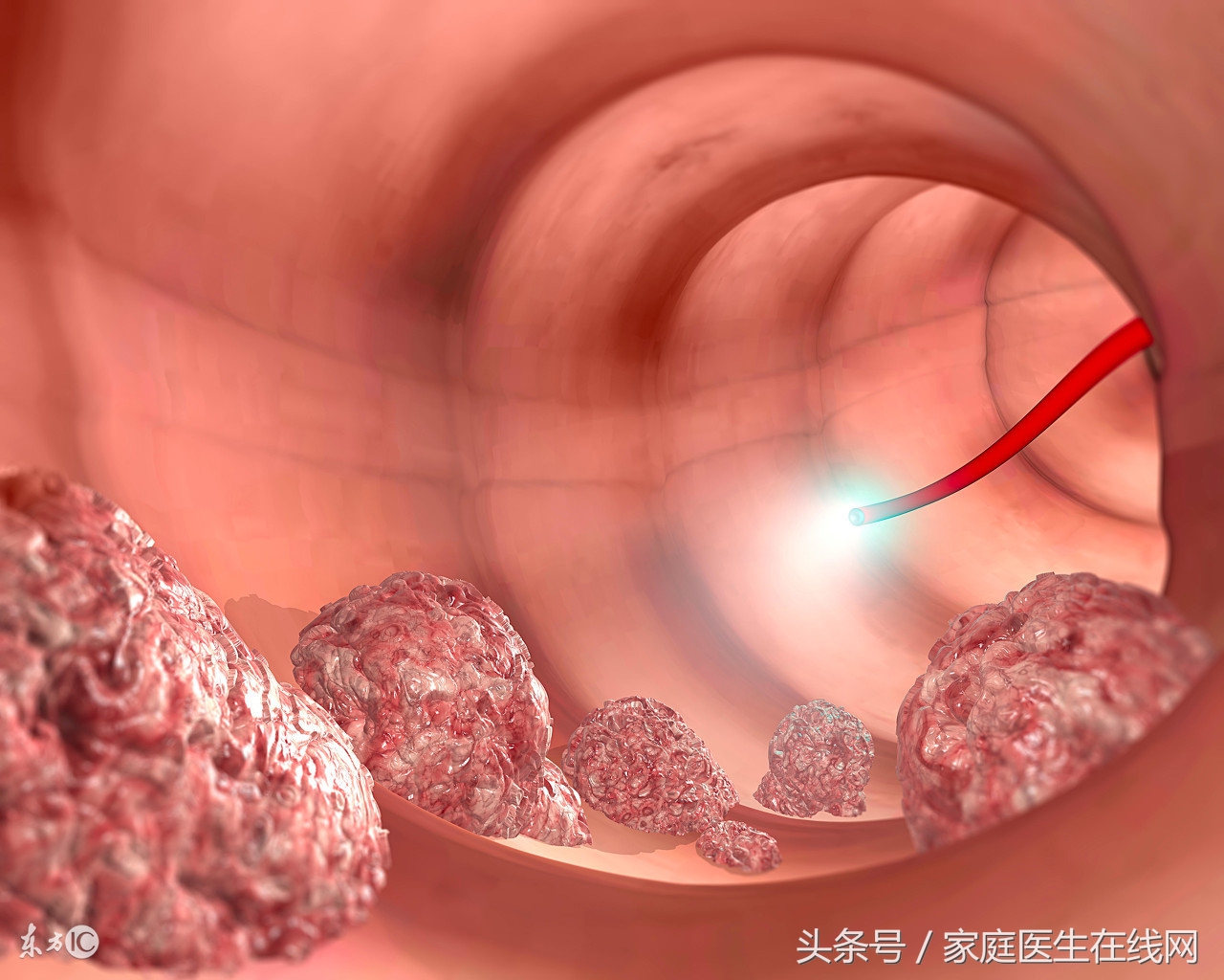 医生提醒这3件事比熬夜还要伤肝,癌细胞最怕你做这5件事